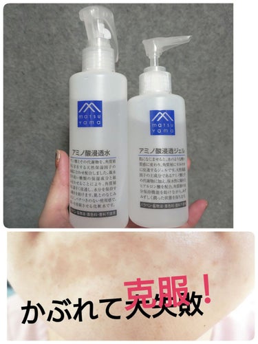 アミノ酸浸透水 200ml/Mマークシリーズ/化粧水を使ったクチコミ（1枚目）