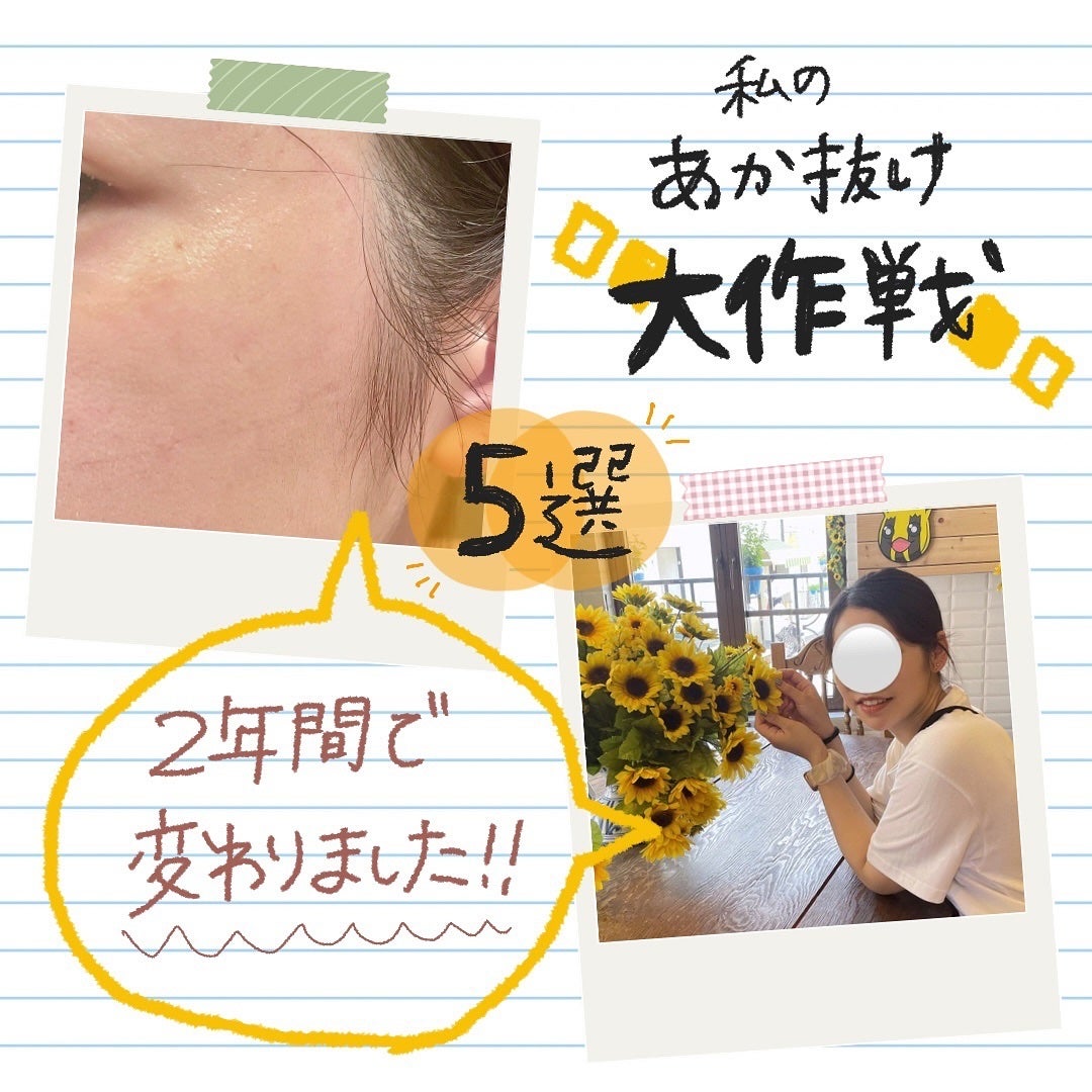 デイリーPD/ZO Skin Health/フェイスクリームを使ったクチコミ(1枚目)