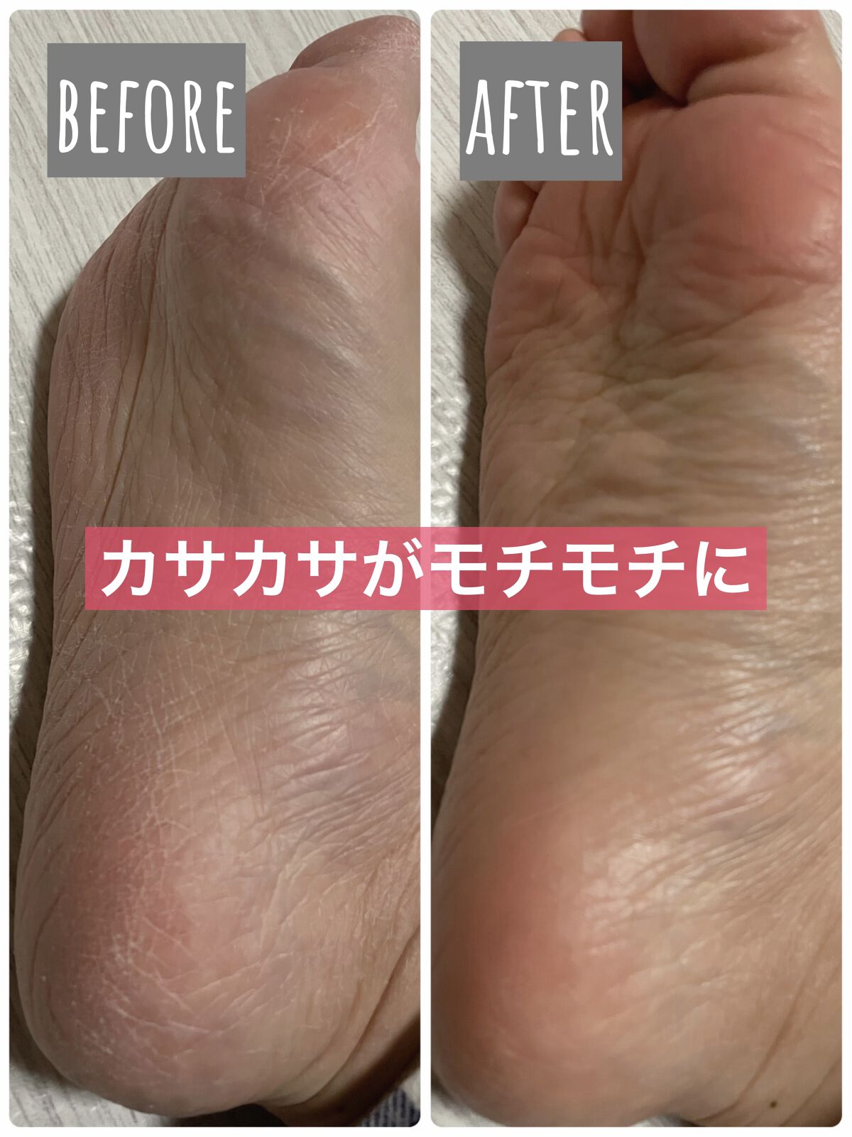 フタアミンhiクリーム/ムサシノ製薬/ハンドクリームを使ったクチコミ（1枚目）