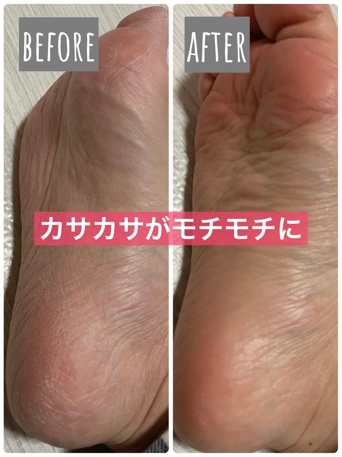 フタアミンhiクリーム/ムサシノ製薬/ハンドクリームを使ったクチコミ(1枚目)