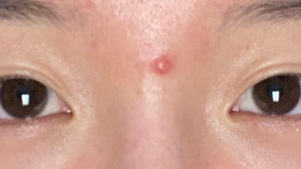 素肌美人VITA/ACROPASS/シートマスク・パックを使ったクチコミ(3枚目)