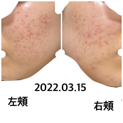 スムースEクリーム/SMOOTH E/フェイスクリームを使ったクチコミ(1枚目)