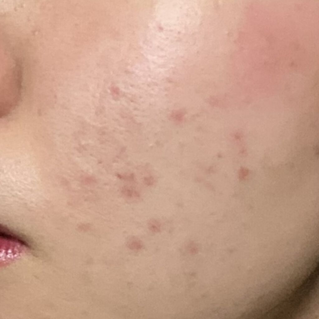 M クッション ファンデーション(モイスチャー)/MISSHA/クッションファンデーションを使ったクチコミ（2枚目）