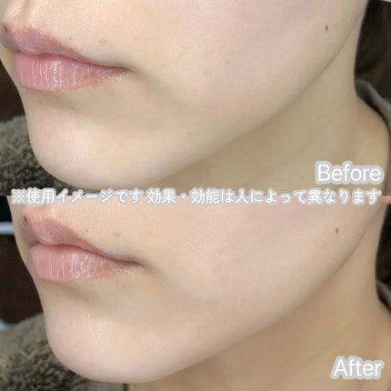 9番 NMNバイオリフトラッピングマスク/numbuzin/シートマスク・パックを使ったクチコミ(4枚目)