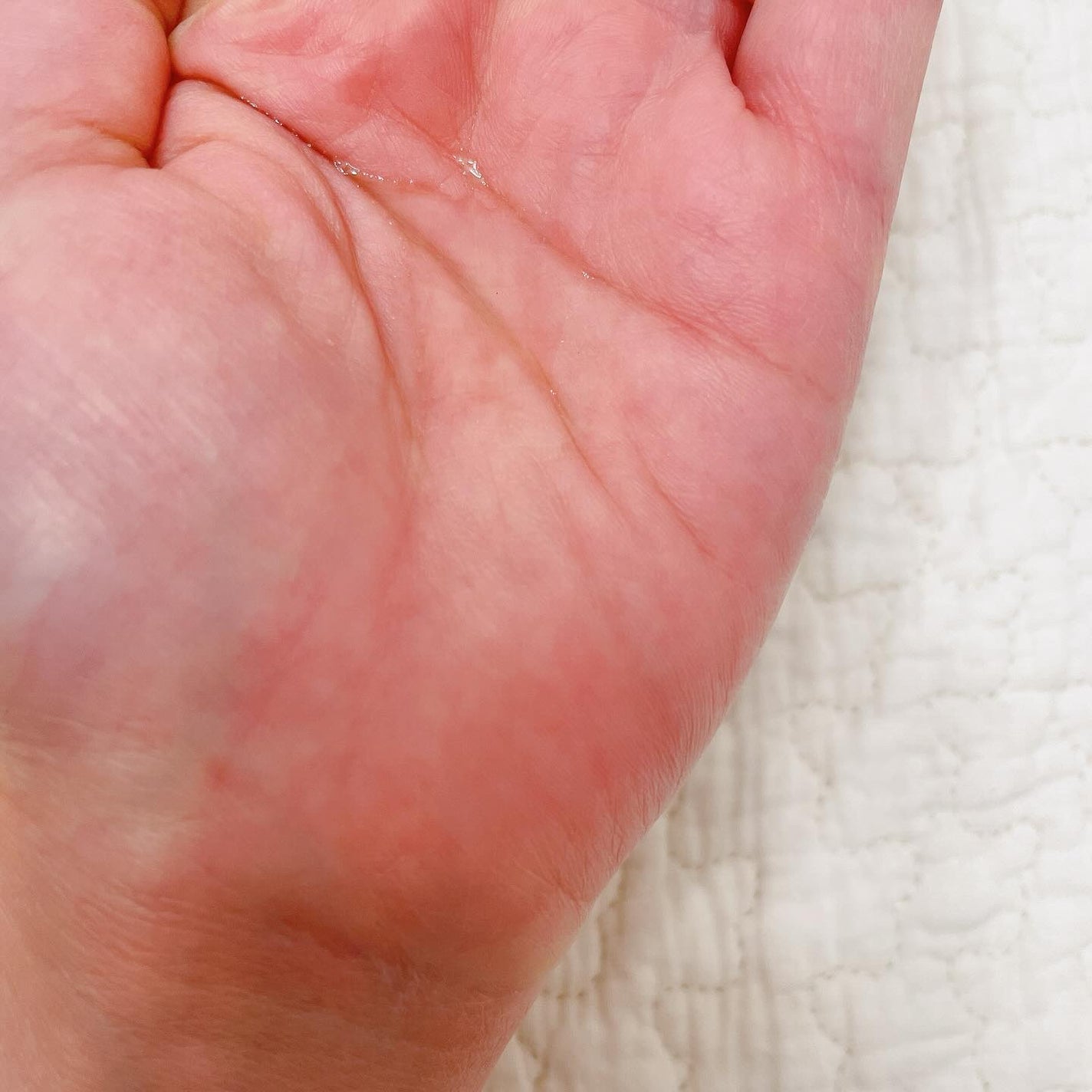 BASIC KIT/ChámU/スキンケアキットを使ったクチコミ(2枚目)