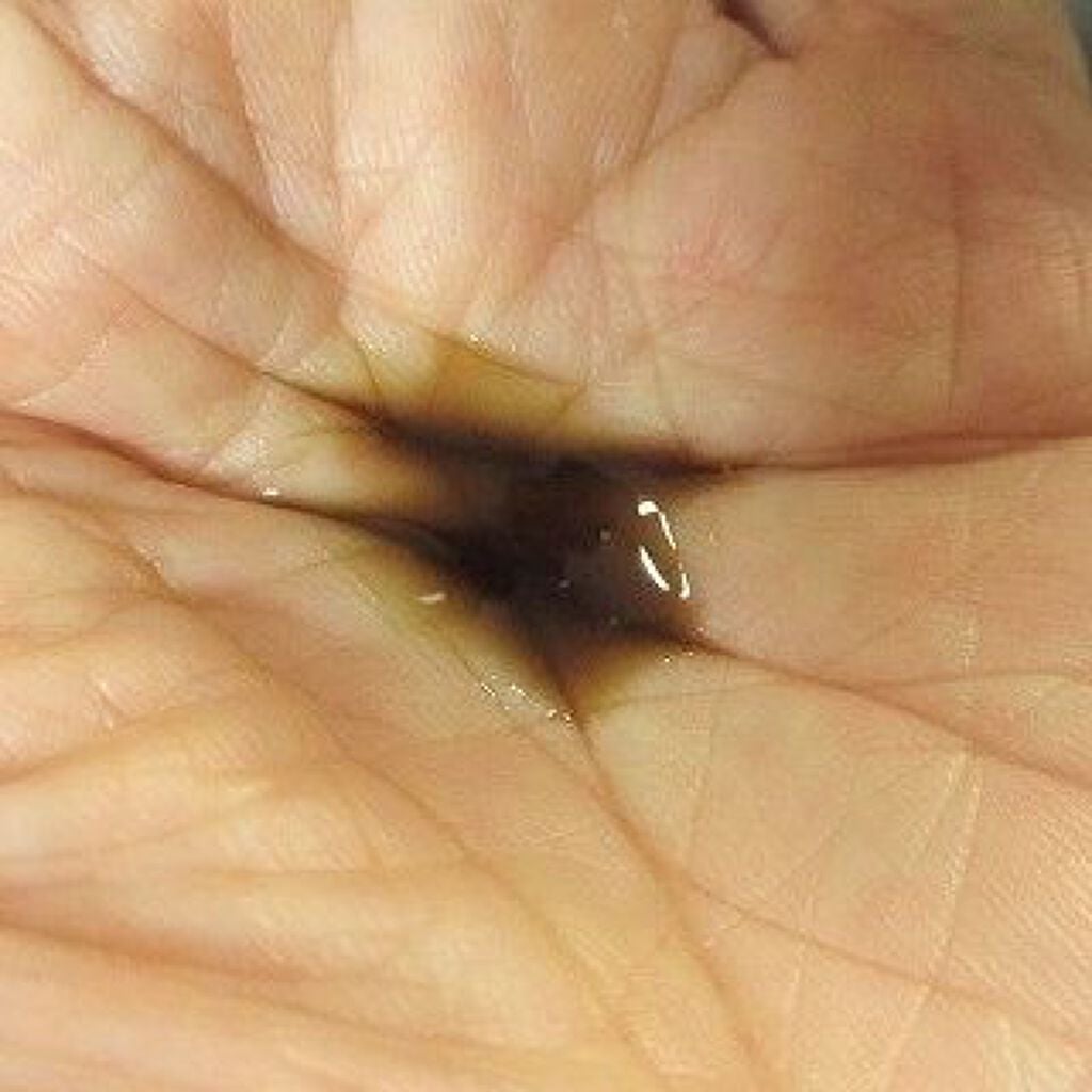 プロヘマチン原液/fracora/洗い流すヘアトリートメントを使ったクチコミ(7枚目)