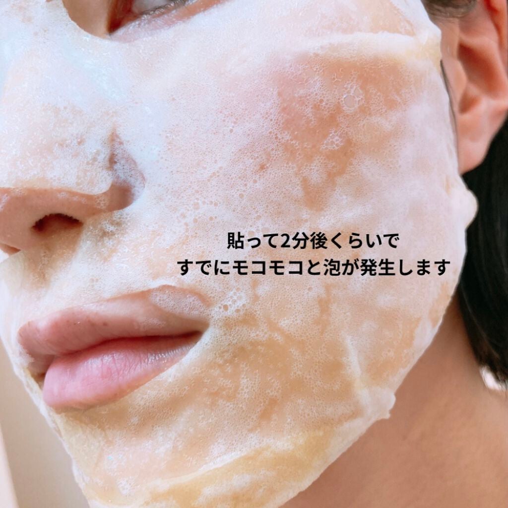 もこもこビタミンC泡マスク/リッツ/シートマスク・パックを使ったクチコミ(2枚目)