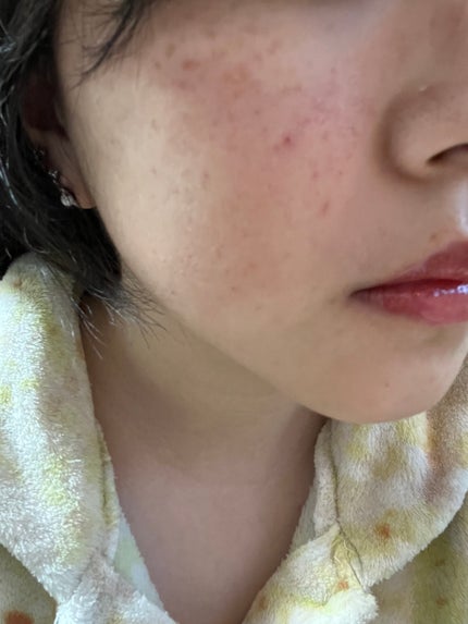 エスポア ビーグロー ボリュームクッション/espoir/クッションファンデーションを使ったクチコミ(6枚目)