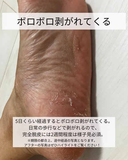 イージーパックDP60分タイプ/ベビーフット/レッグ・フットケアを使ったクチコミ(4枚目)