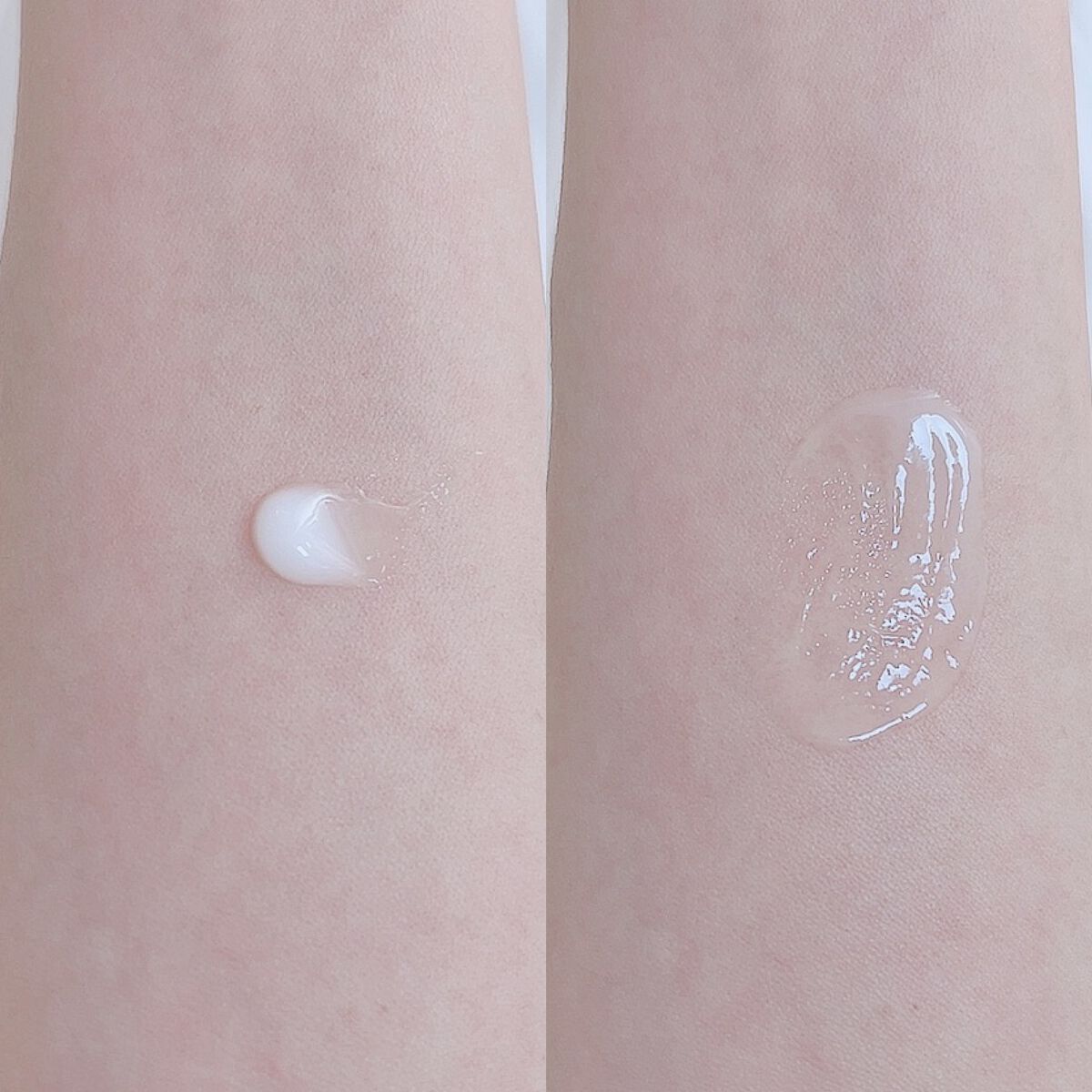 薬用CICAクリーム/アクネスラボ/フェイスクリームを使ったクチコミ（2枚目）