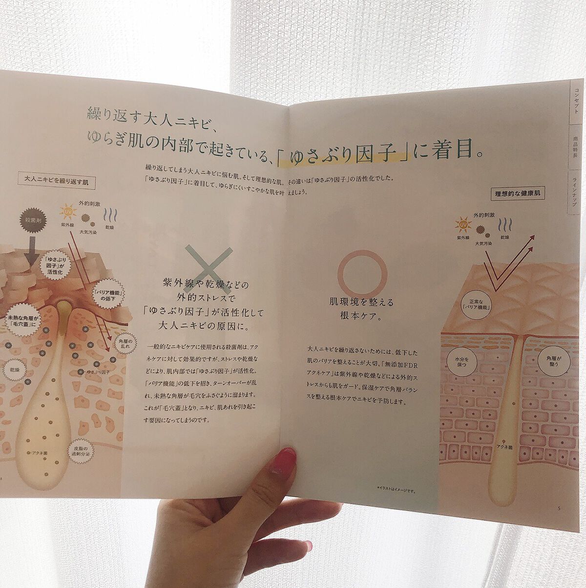 アクネケア 化粧液　＜医薬部外品＞/ファンケル/化粧水を使ったクチコミ（2枚目）