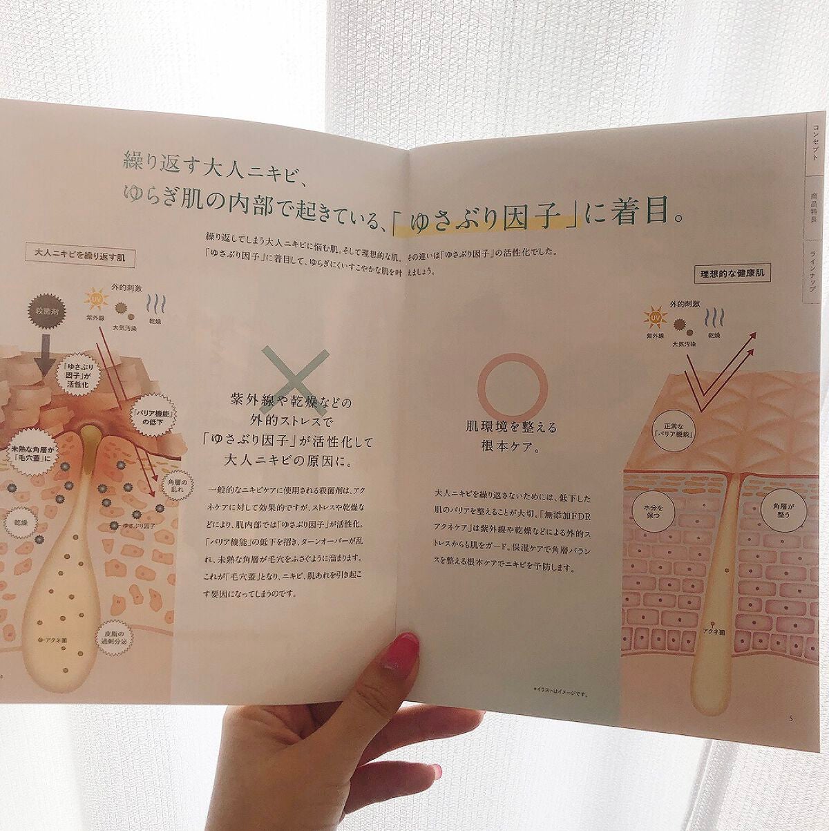 アクネケア ジェル乳液 <医薬部外品>/ファンケル/乳液を使ったクチコミ(2枚目)