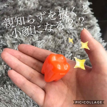 スキンケアオタク🤍A on LIPS 「親知らず抜歯体験レポ(๑ơơ)✨小顔になるって本当？費用は？痛..」（1枚目）