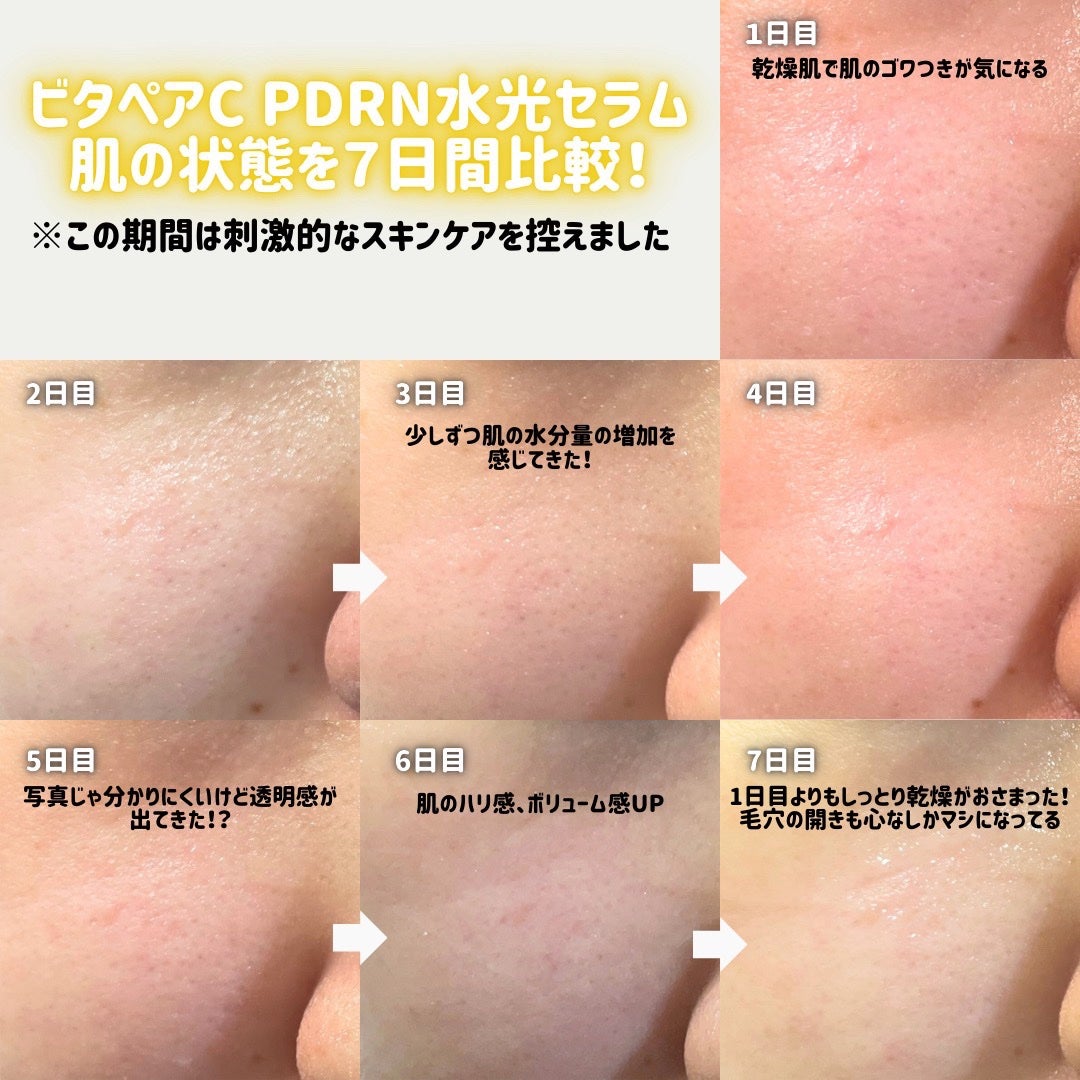 マリンPDRNデイリーシートマスク/ネイチャーリパブリック/シートマスク・パックを使ったクチコミ(4枚目)