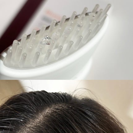 グローターン 100ml/リリーイブ/頭皮ローションを使ったクチコミ(6枚目)