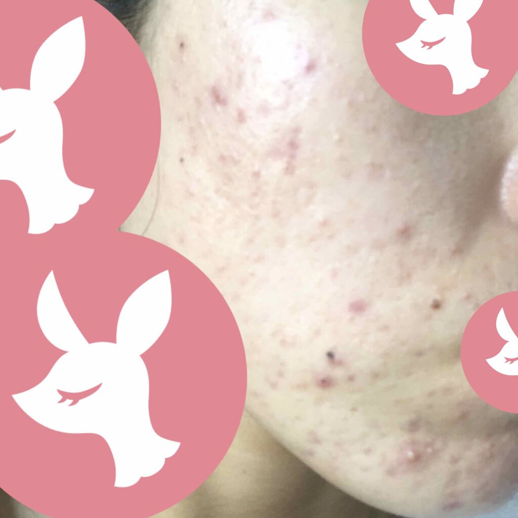 薬用エマルジョン/IHADA/乳液を使ったクチコミ（1枚目）