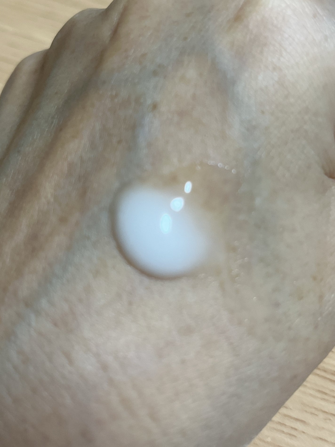 リードルショット300/VT/美容液を使ったクチコミ(1枚目)