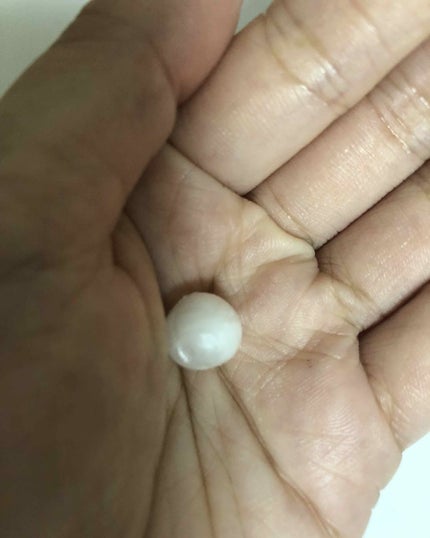 リアルヒアルロニック ブルーワンデーキット/Wellage/美容液を使ったクチコミ(2枚目)