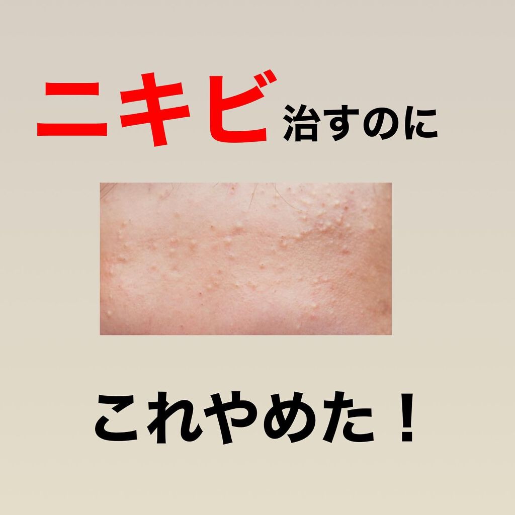 kento@パーソナルスキンケア on LIPS 「こんばんは!けんとです!!ニキビ治すためにこれやめたよ!#ニキ..」(1枚目)