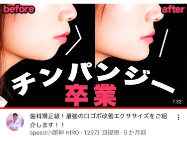 【最強の口ゴボ改善エクササイズ】


コロナでずっとマスク生活…
マスクをずっと付けるって苦しいですよね😭

気づいたら口呼吸になってしまい
それが習慣づいてしまうこともあります😢

マスクをずっと付け