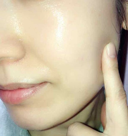 ルルルンプレシャス GREEN(バランス)【旧】/ルルルン/シートマスク・パックを使ったクチコミ(4枚目)