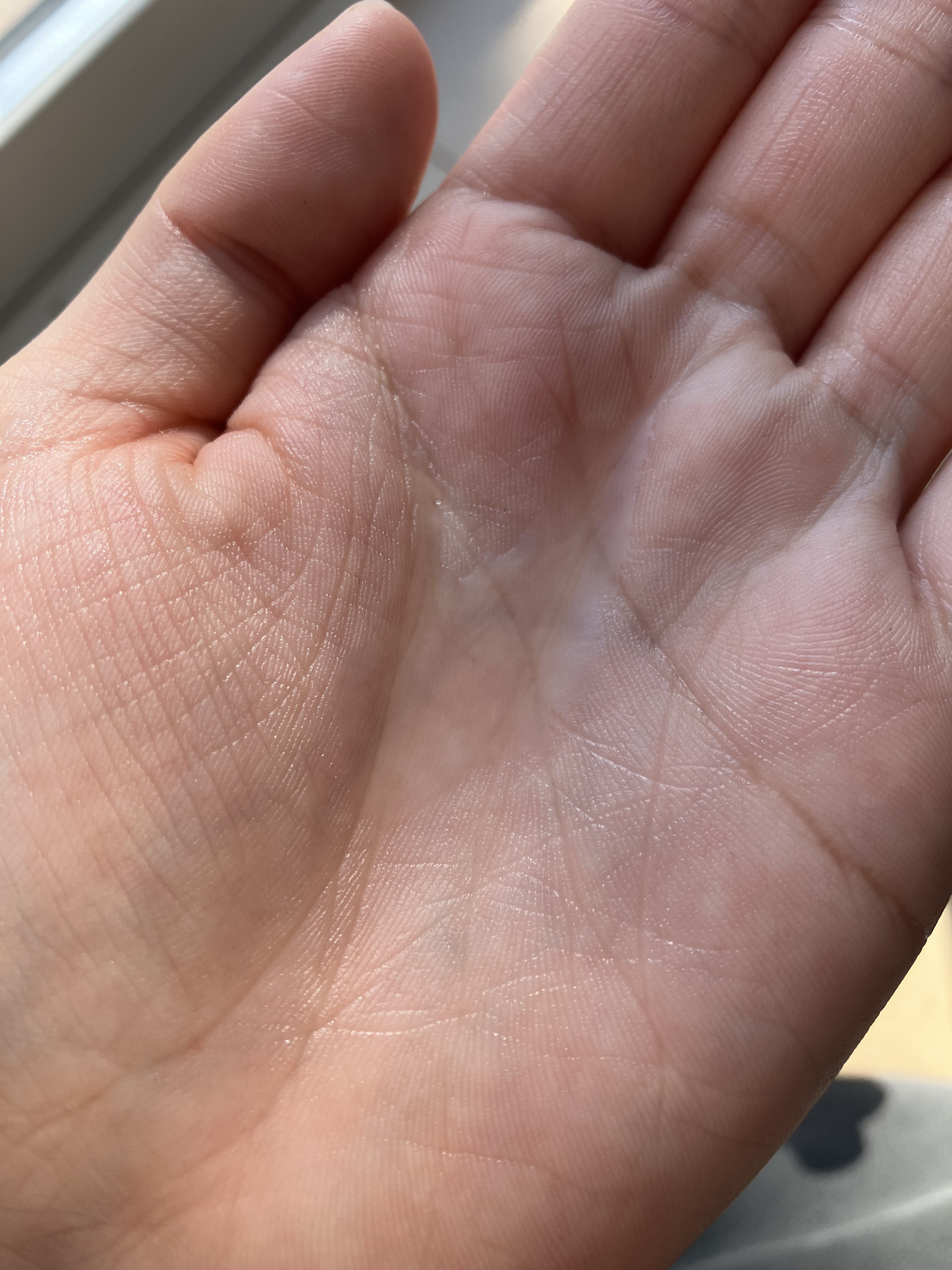 ドクダミ 77 スージングトナー/Anua/化粧水を使ったクチコミ（2枚目）