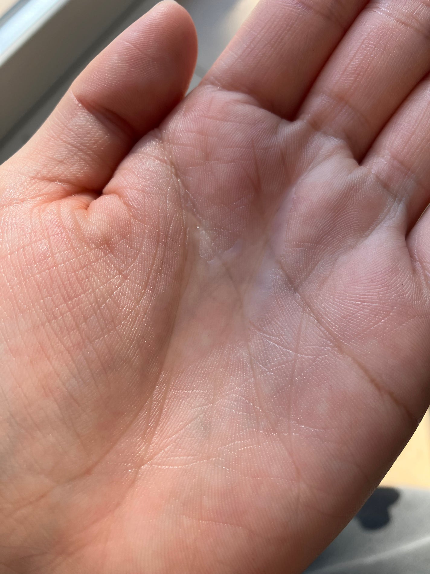 ドクダミ 77 スージングトナー/Anua/化粧水を使ったクチコミ(2枚目)