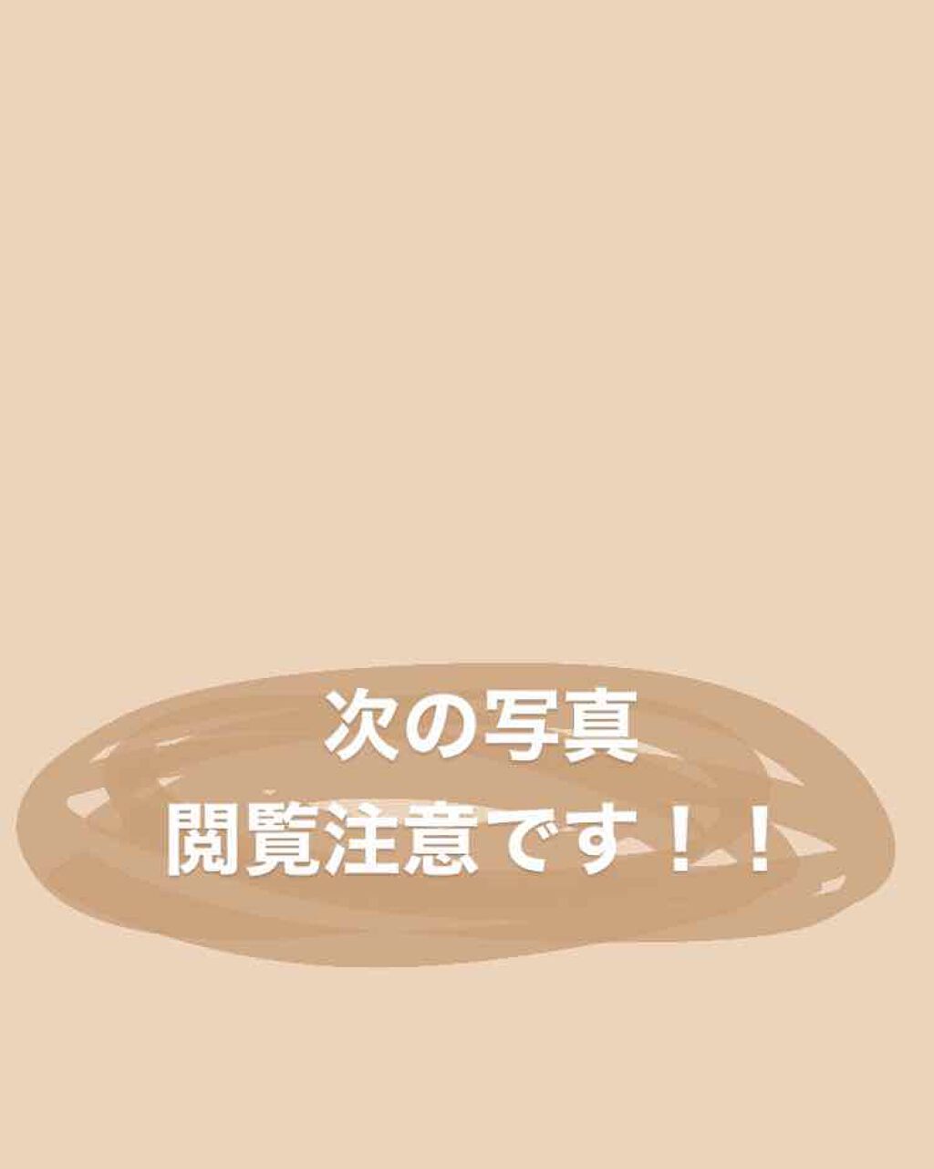 を使ったクチコミ（1枚目）