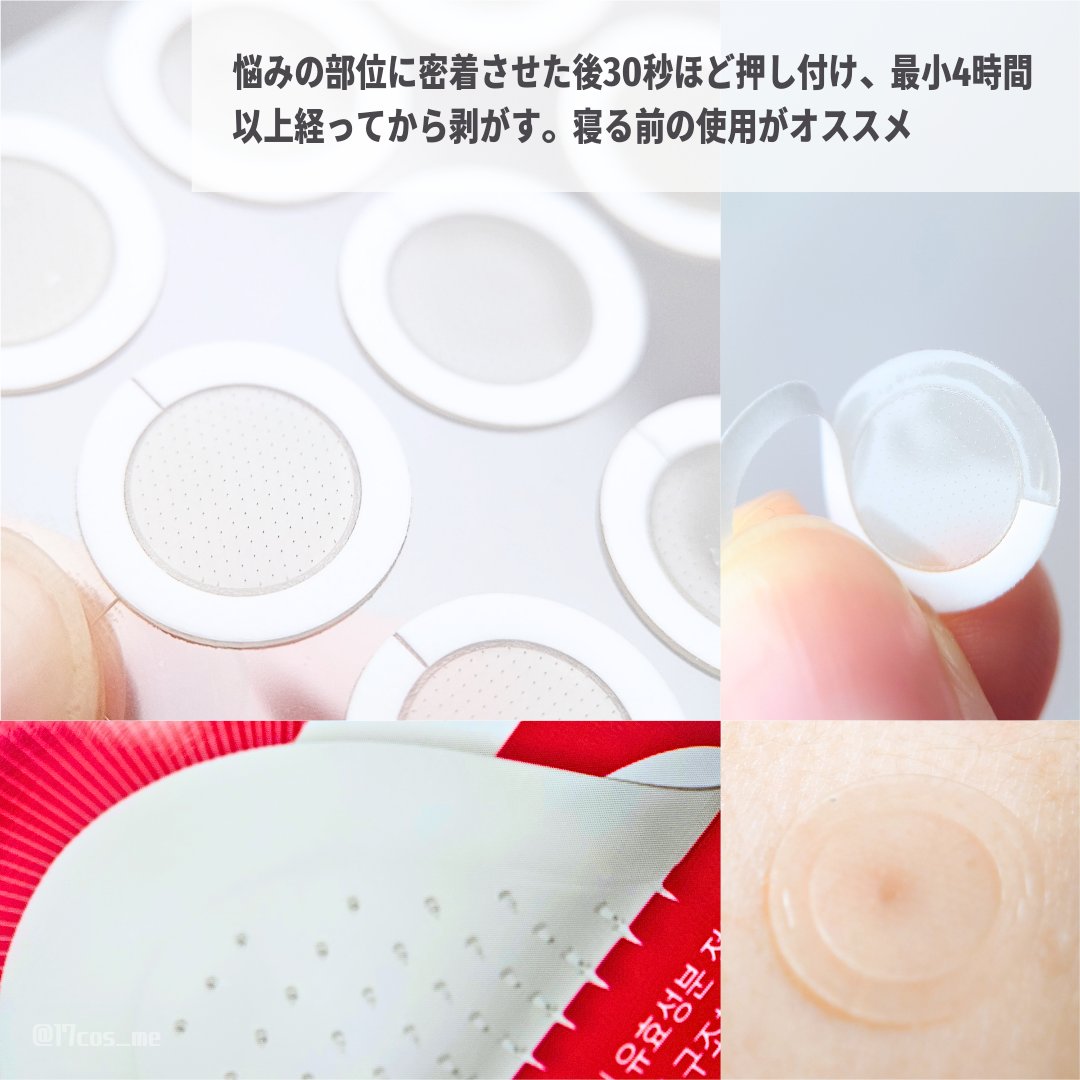 エーキュアショットスポットパッチ/obsero/にきびパッチを使ったクチコミ（3枚目）