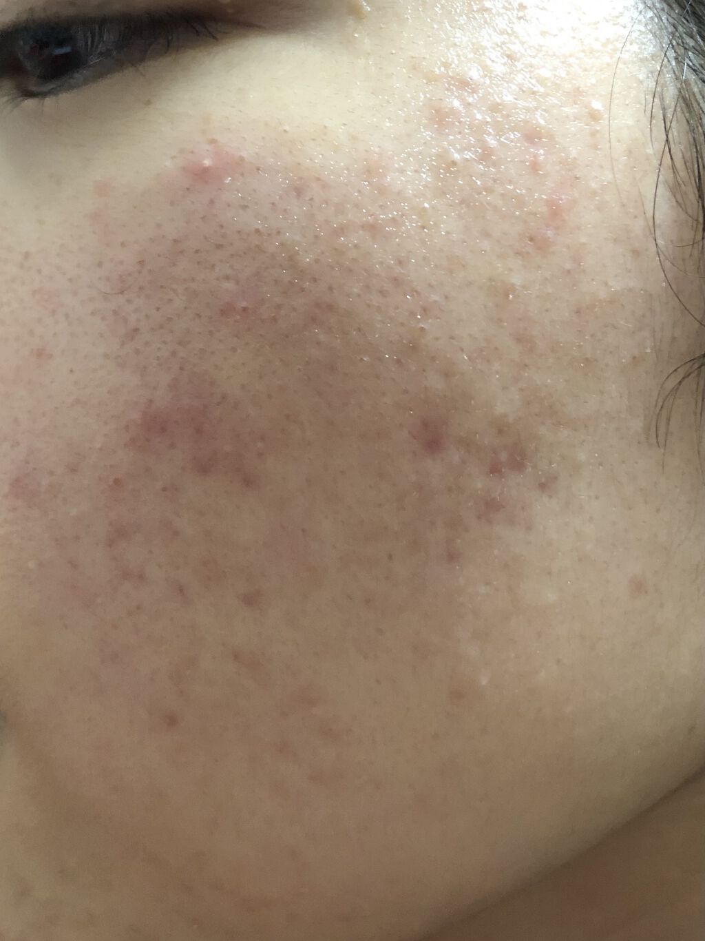 スキンケア洗顔料 モイスチャー/ビオレ/洗顔フォームを使ったクチコミ（1枚目）