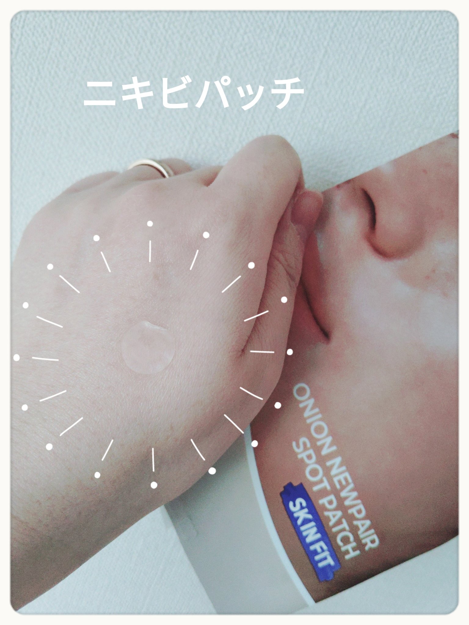 Isntree オニオンニューペアスポットパッチ スキンフィットのクチコミ「Isntree　オニオンニューペアスポットパッチ スキンフィット

みなさん、こんばんは☺　
.....」（1枚目）