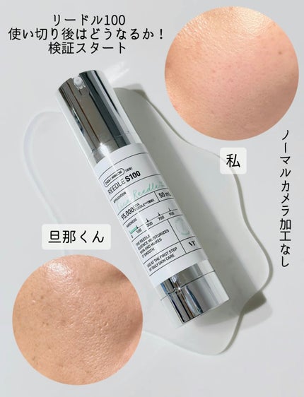 リードルショット100/VT/美容液を使ったクチコミ(4枚目)