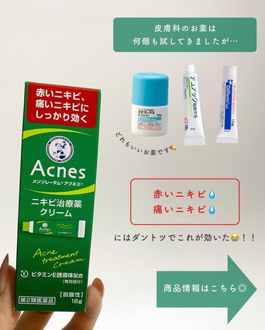 メンソレータム アクネス ニキビ治療薬(医薬品)のクチコミ「【皮膚科の薬より効いた😳！？】市販最強ニキビ薬🤍
⁡
皮膚科のニキビ薬もたくさん試してきました.....」（2枚目）