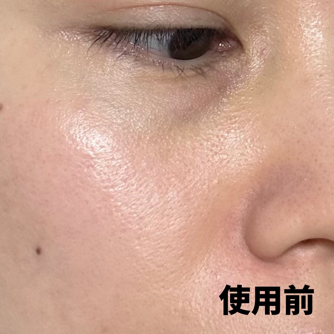 PDRNピンクアンプル PDRN 10,000ppm配合/MEDICUBE/美容液を使ったクチコミ（3枚目）