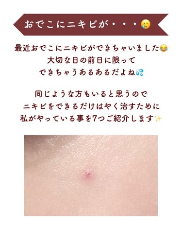 ルルルン 薬用ルルルン 美白アクネのクチコミ「【ニキビを目立たせない7つのこと🚑🚨】
.
最近おでこにニキビができちゃいました😂
昔は当たり.....」（2枚目）