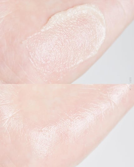 ポアセラリアルビフィダパウダーセラム/MEDITHERAPY/美容液を使ったクチコミ(5枚目)