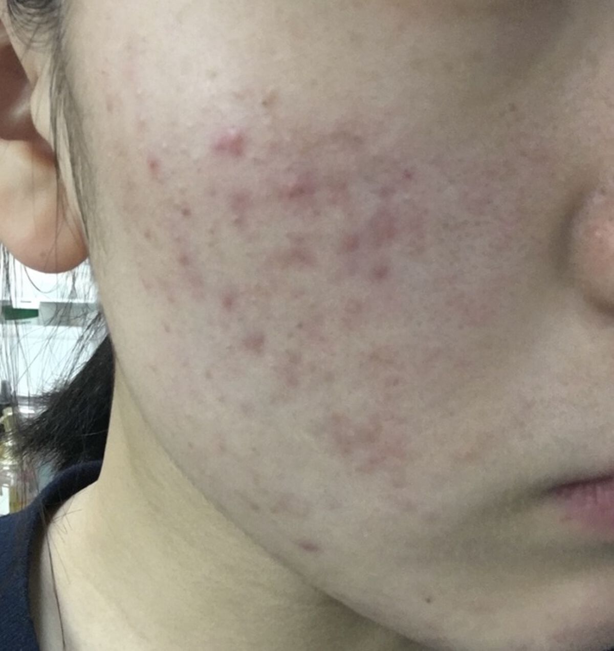 化粧水・敏感肌用・高保湿タイプ/無印良品/化粧水を使ったクチコミ（2枚目）