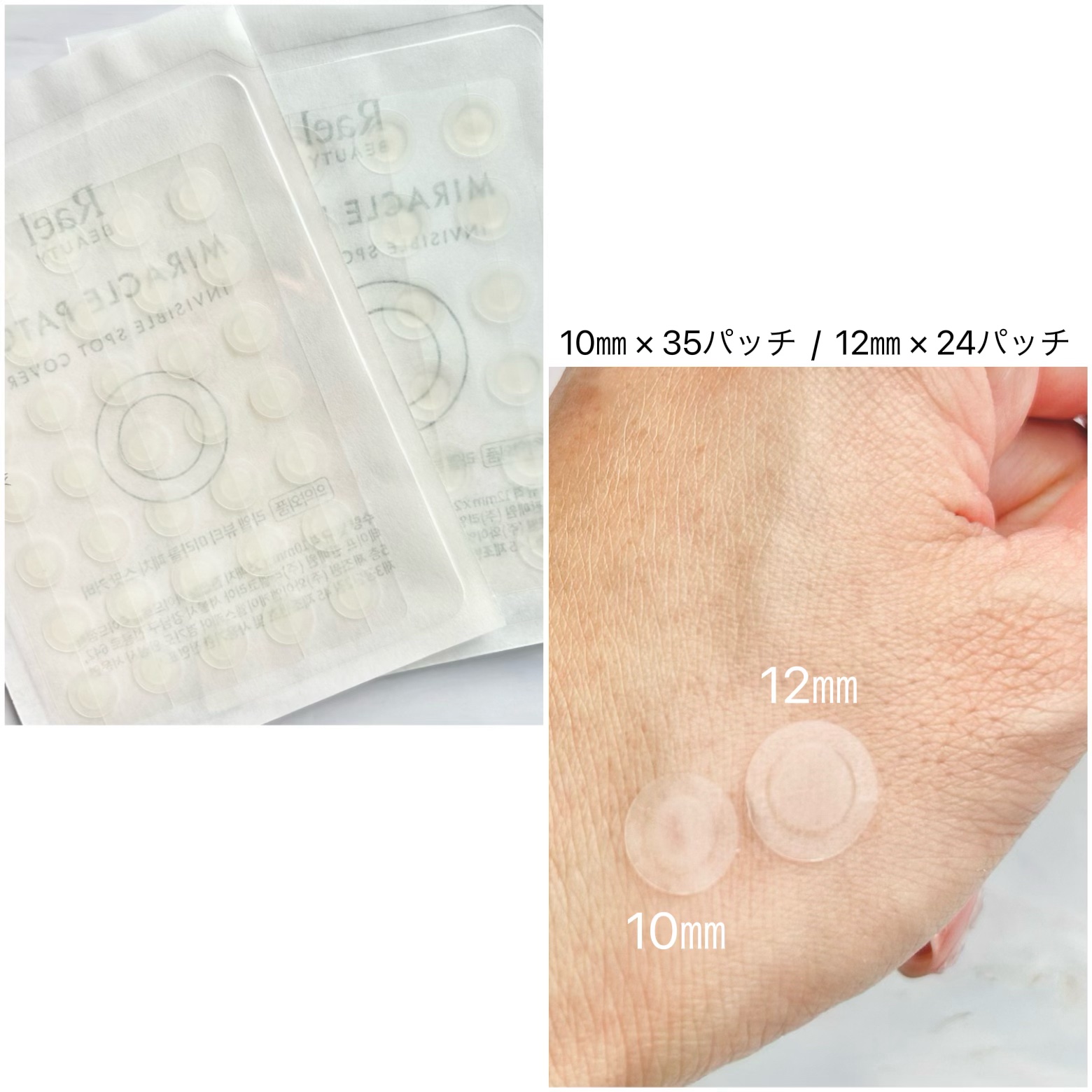 ビューティーミラクルパッチスポットカバー/Rael/にきびパッチを使ったクチコミ（3枚目）