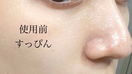 ガラクナイアシン2.0エッセンス/manyo/美容液を使ったクチコミ(3枚目)