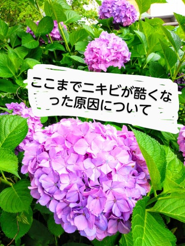 
私のニキビは細かいコメドが多く、炎症で赤くなるタイプのニキビはたまに出来るくらいでした。
ですがお化粧をするとすぐ脂で崩れてしまうし、日の光にあたるとすごくニキビが目立つんです😭なんとか市販の物で治せ