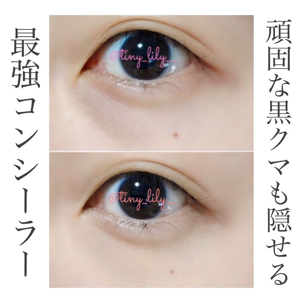 ミネラルコンシーラーパレット/エトヴォス/パレットコンシーラーを使ったクチコミ（1枚目）