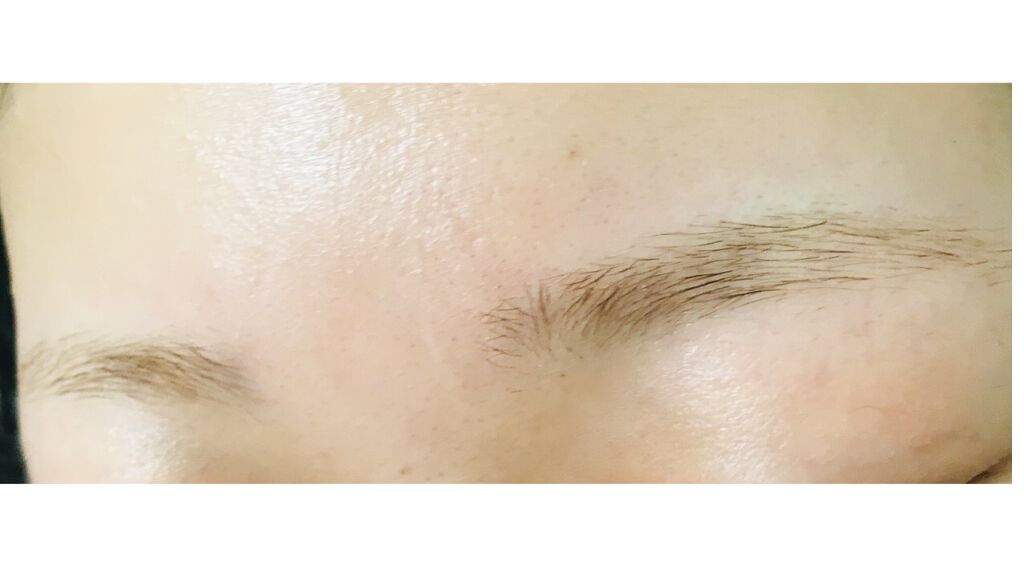 脱色クリーム 敏感肌用/エピラット/ムダ毛ケアを使ったクチコミ（3枚目）