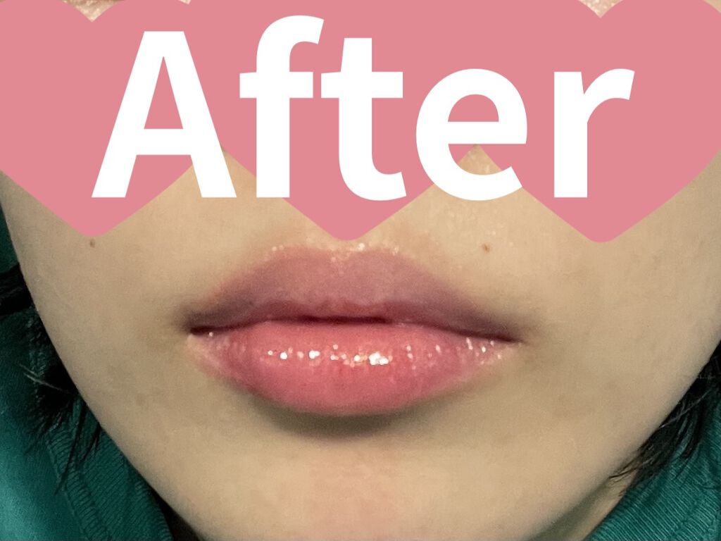 アフターグロー リップバーム 5055/NARS/リップバームを使ったクチコミ（3枚目）