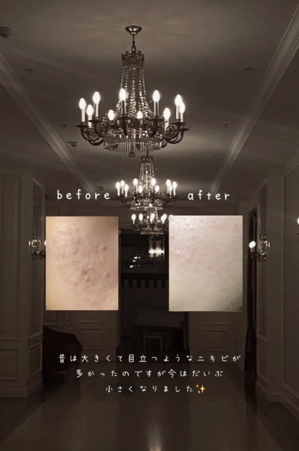 薬用CICAリペア クリーム/タイガレイド/フェイスクリームを使ったクチコミ（2枚目）