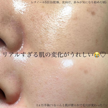 RXザ・レチノール0.1クリーム/COSRX/フェイスクリームを使ったクチコミ(3枚目)