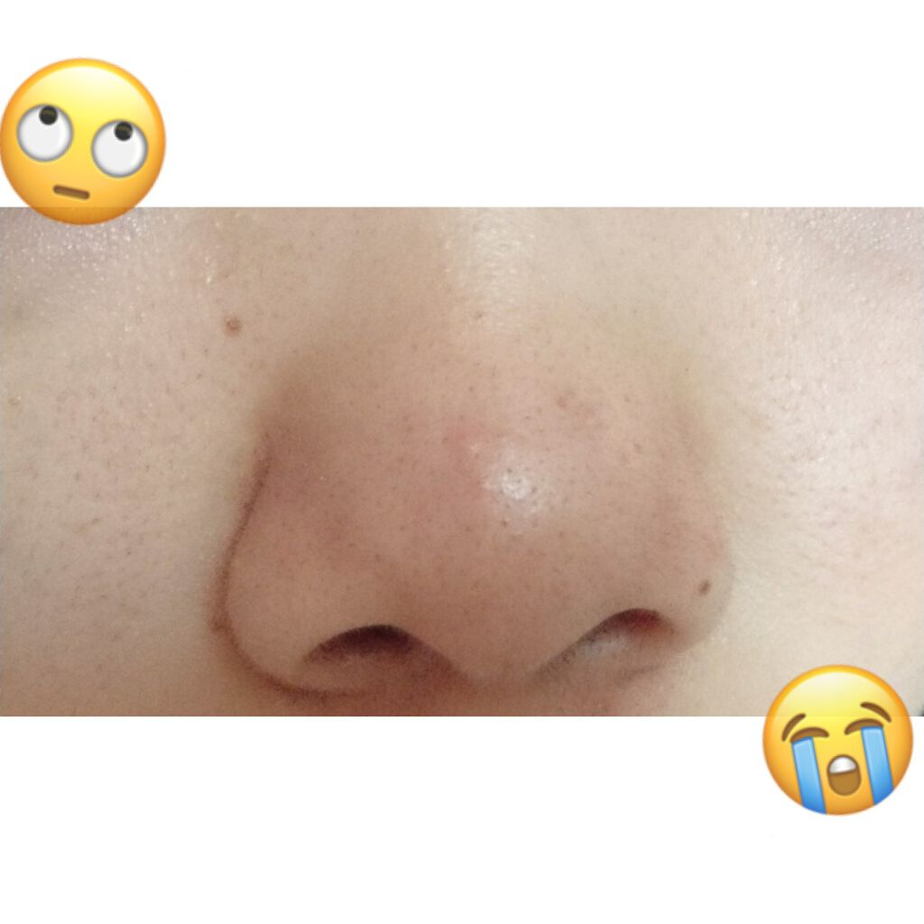 ハトムギ化粧水(ナチュリエ スキンコンディショナー R )/ナチュリエ/化粧水を使ったクチコミ（2枚目）