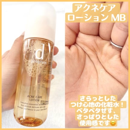 アクネケア ローション MB/d プログラム/化粧水を使ったクチコミ(2枚目)