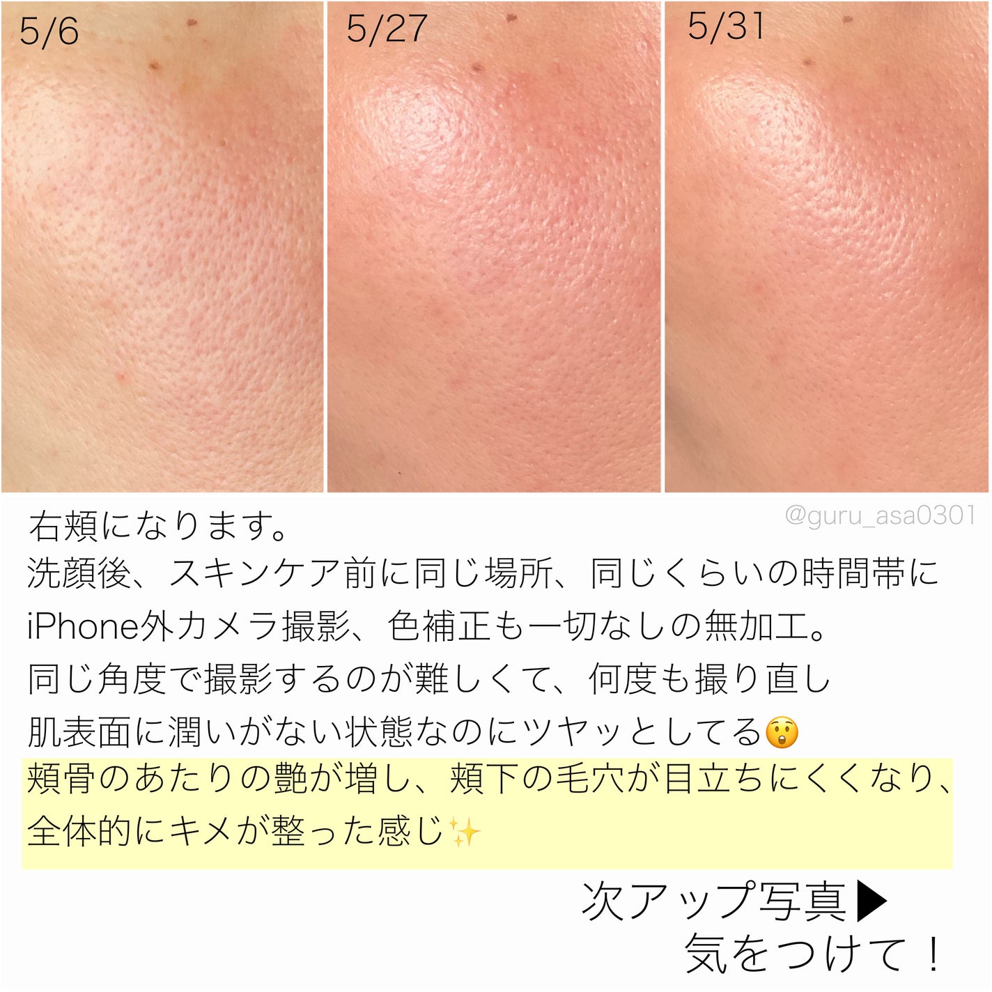 シカレチA エッセンス0.1/VT/美容液を使ったクチコミ(6枚目)