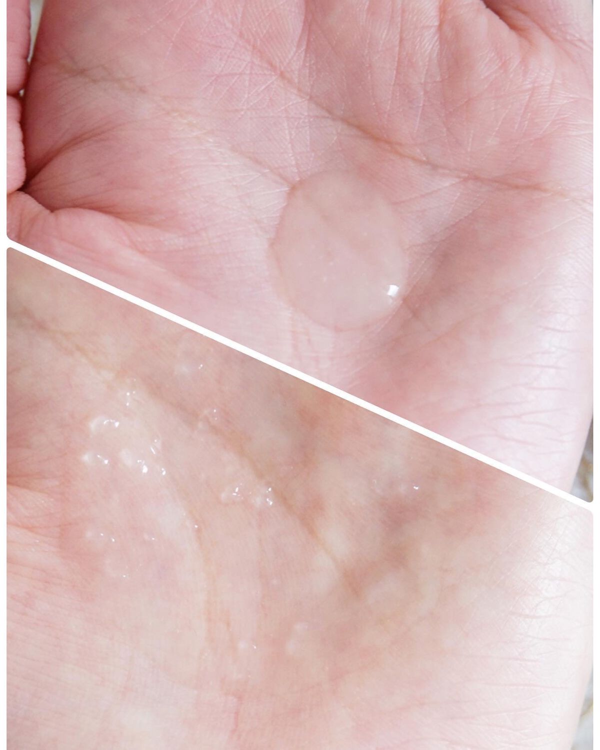 アンリミテッド キー/インフィニティ/美容液を使ったクチコミ（2枚目）