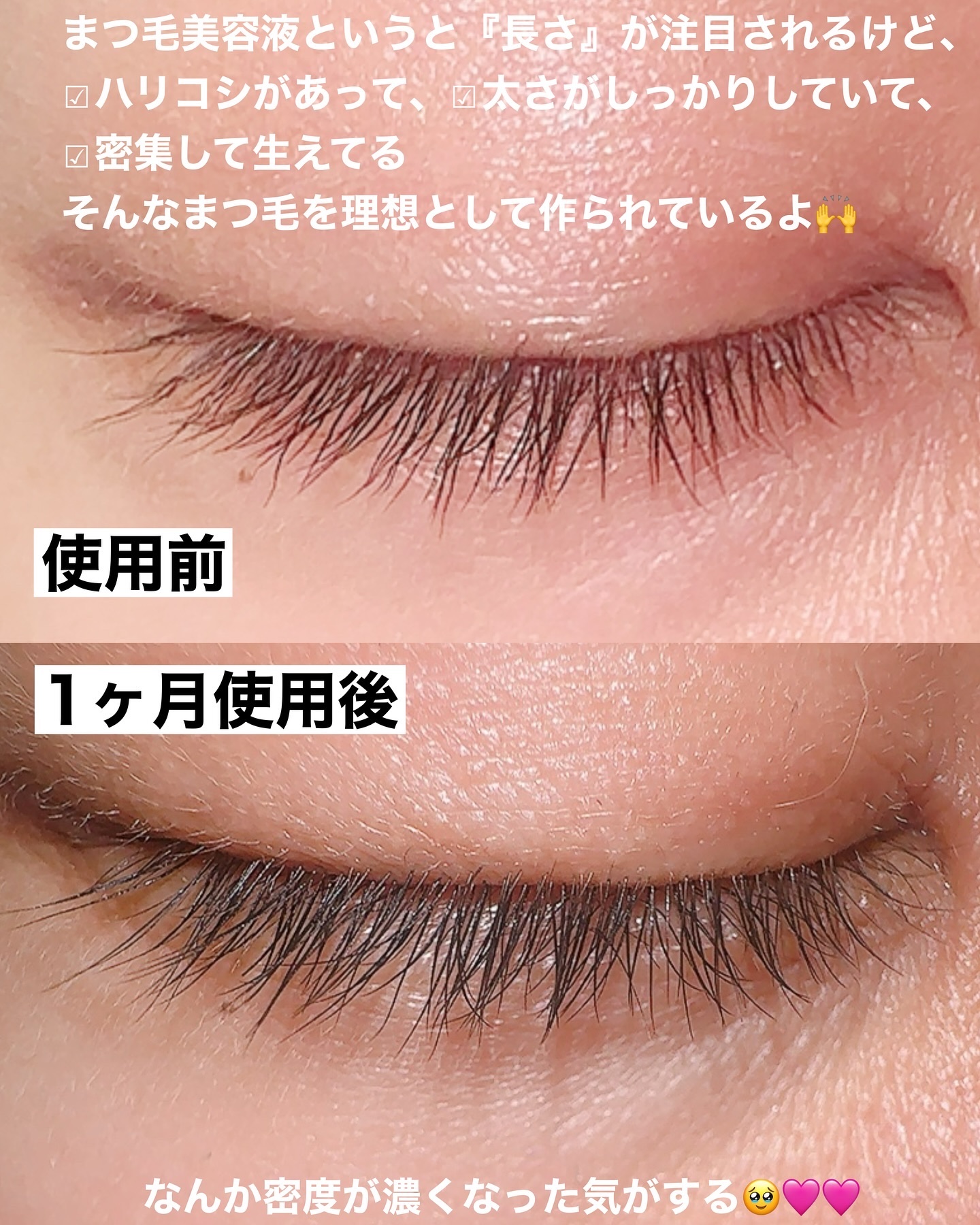 ラッシュリッチアイラッシュセラム｜ロート製薬の使い方を徹底解説